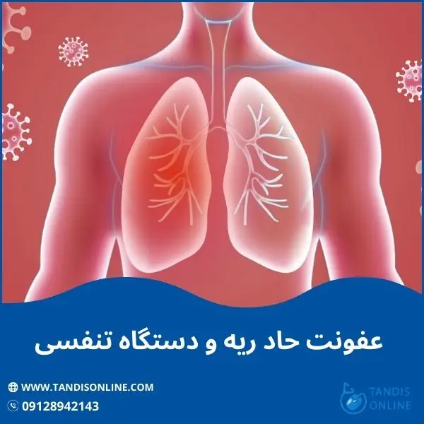 عفونت حاد ریه و دستگاه تنفسی